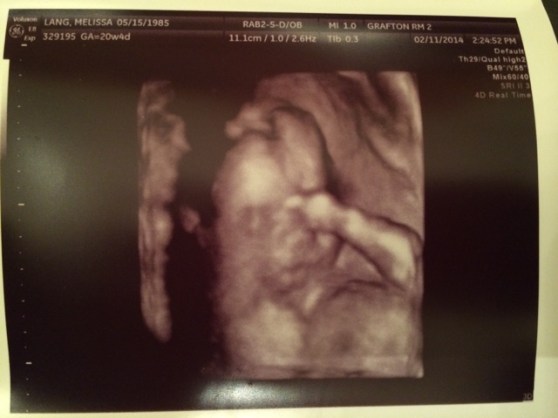 My favorite little face pic. She's just so precious with her little hand up by her face. I can't wait to kiss that little face.