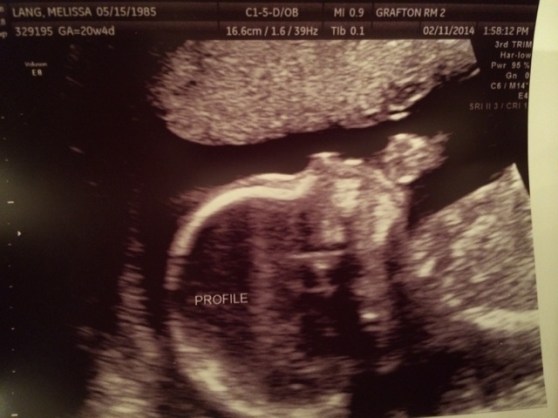 Mini hand by the sweet face profile.