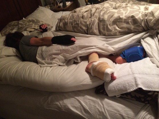 While this looks like a joke, this is literally how my weekend ended. Both hands in my carpal tunnel splints and a little extra special bonus, ice packs strapped to my feet to help with the pain and swelling in those giant paddles. Yikes.